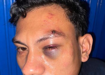 LMND Aceh Kecam Represifitas Brimob dalam Aksi Sumpah Pemuda