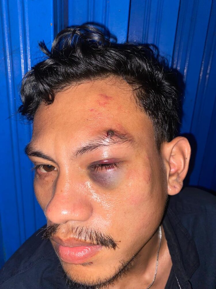 LMND Aceh Kecam Represifitas Brimob dalam Aksi Sumpah Pemuda